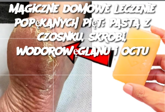 Magiczne domowe leczenie popękanych piętnaście: pasta z czosnku, skrobi, wodorowęglanu i octu