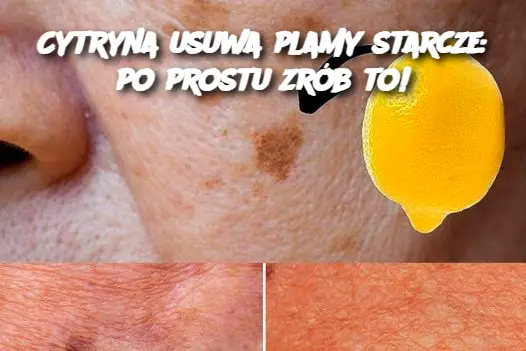 Cytryna usuwa plamy starcze: po prostu zrób to!”