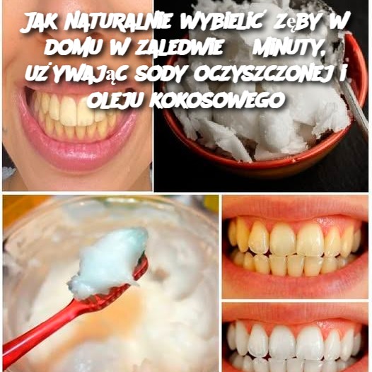 Jak naturalnie wybielić zęby w domu w zaledwie 3 minuty, używając sody oczyszczonej i oleju kokosowego