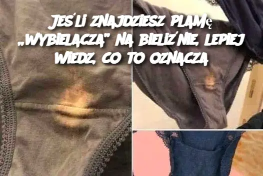 Jeśli Znajdziesz Plamę „Wybielacza” na Bieliznie – Co To Może Oznaczać?