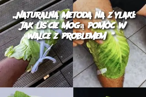 Naturalna metoda na żylaki: Jak liście mogą pomóc w walce z problemem?”