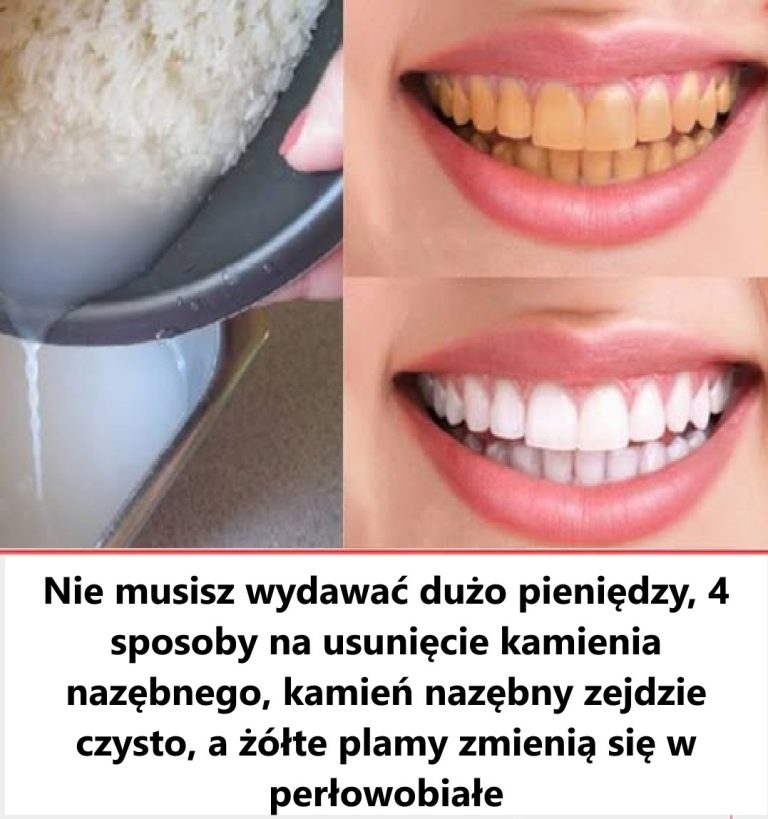 Nie marnuj więcej pieniędzy na dentystę.