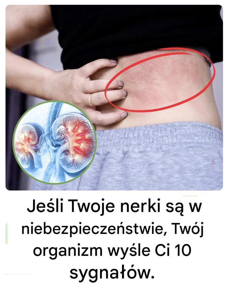 Twoje ciało wyśle ​​Ci te 10 znaków, jeśli Twoje nerki są w niebezpieczeństwie