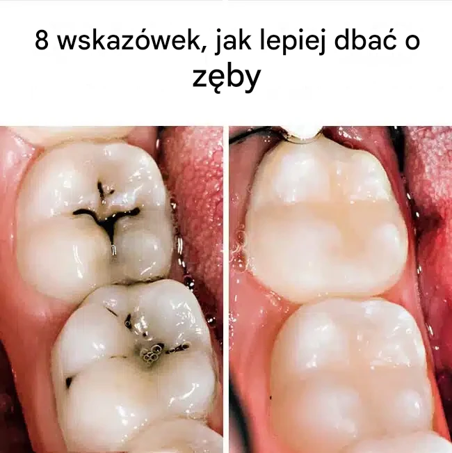 8 wskazówek, jak lepiej dbać o zęby