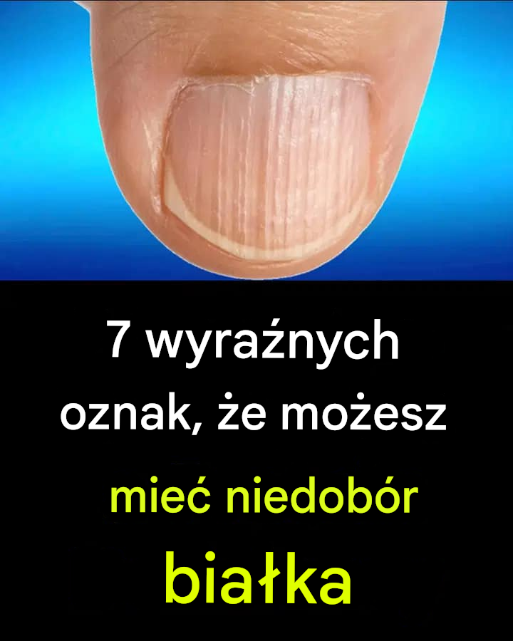 7 wyraźnych oznak, że możesz mieć niedobór białka