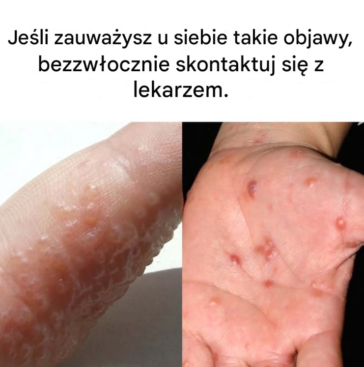 Wypalenie zawodowe: dowiedz się, jak rozpoznać prawdziwe objawy