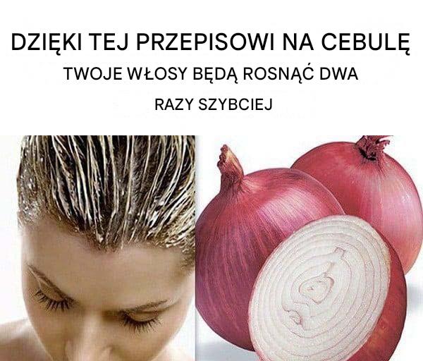 Wypadanie włosów: poznaj tę wskazówkę, która stymuluje wzrost włosów.