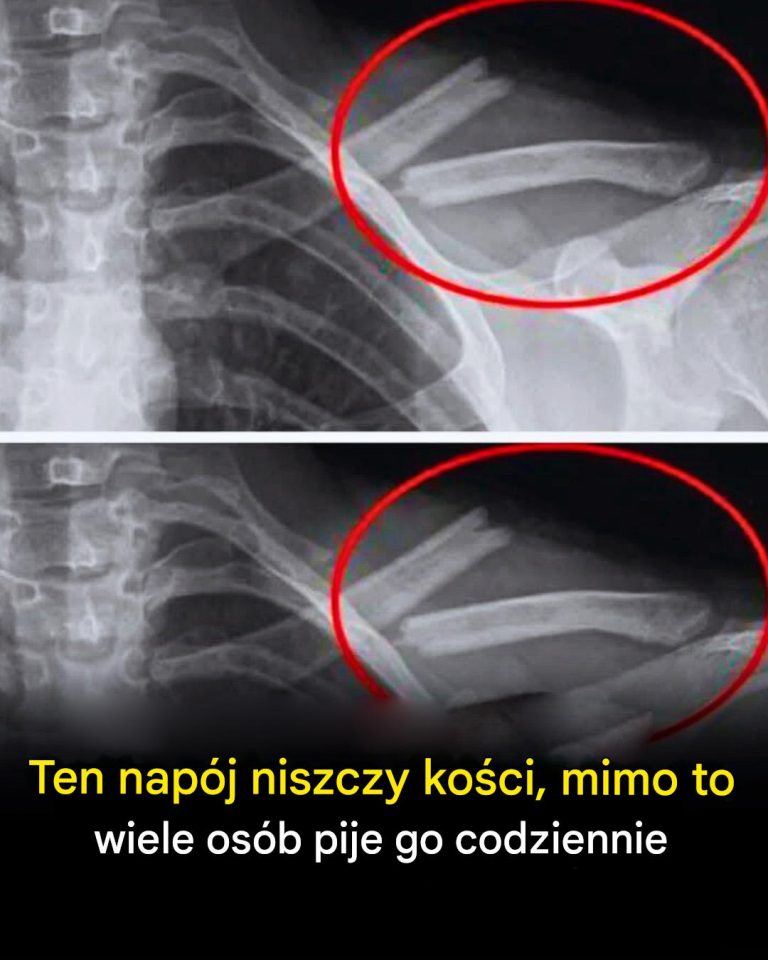 Ten napój niszczy kości, mimo to wiele osób pije go codziennie