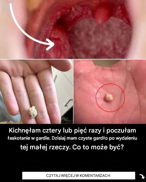Jakie są powody Twojej operacji?