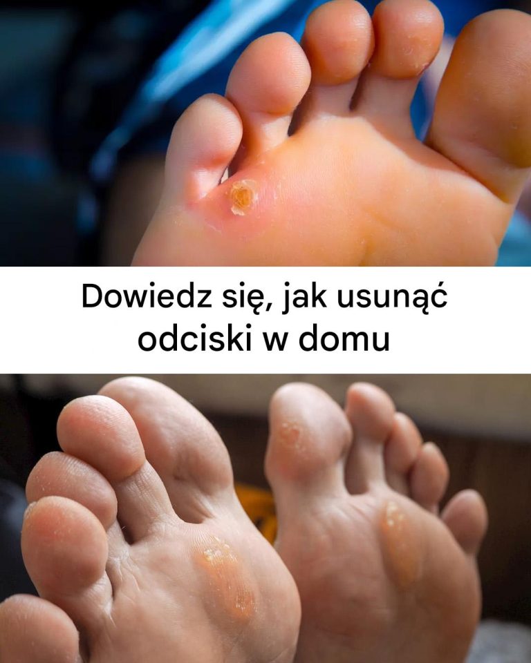 Jakie są metody usuwania odcisków?