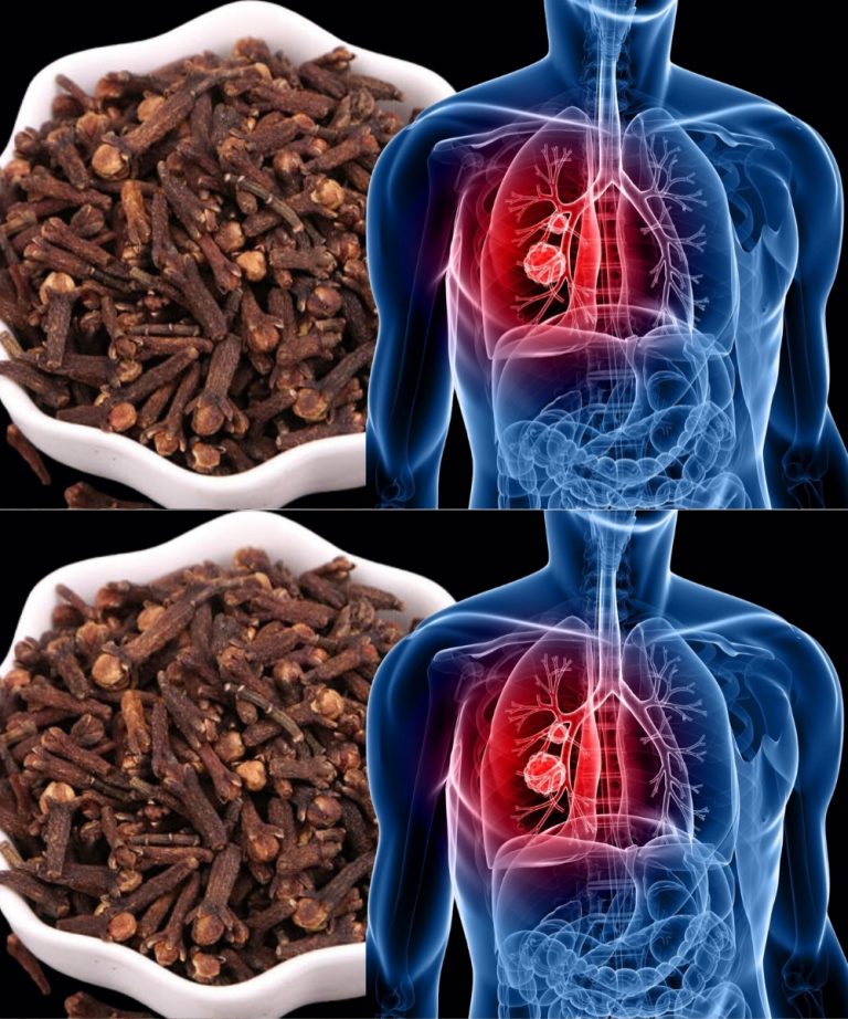 Lepsze oddychanie w sposób naturalny: jak goździki mogą pomóc w walce z infekcjami układu oddechowego i zapaleniem oskrzeli