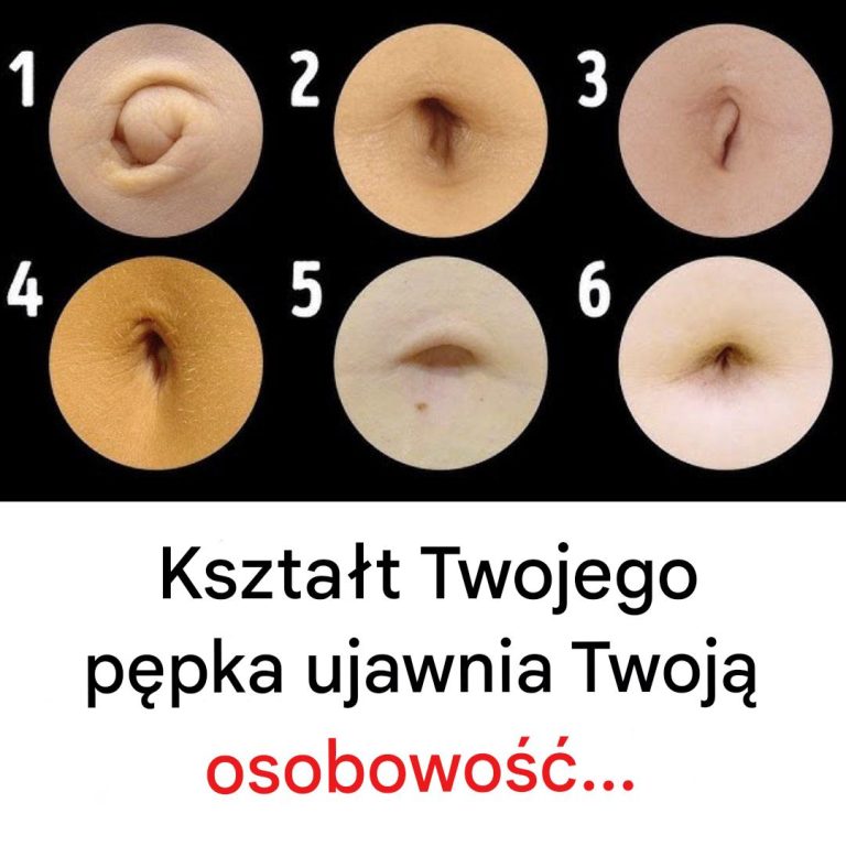 Kształt Twojego pępka mówi wiele o Twojej osobowości