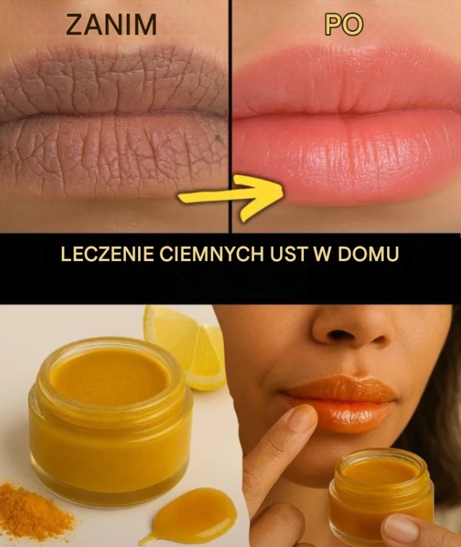 Pożegnaj się z ciemnymi ustami w zaledwie 10 minut dziennie — dzięki tej skutecznej domowej rutynie!