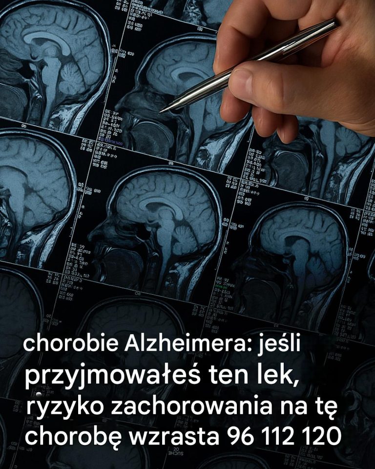 Choroba Alzheimera: zidentyfikowano 6 potencjalnych przyczyn i sposoby na zmniejszenie ich wpływu