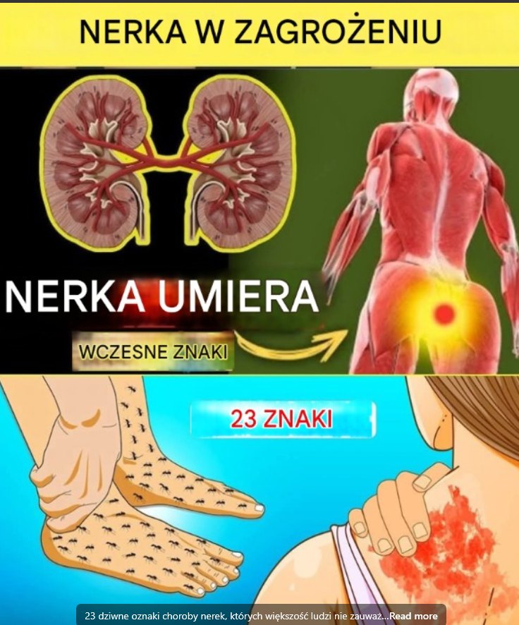 Tytuł: 23 nietypowe objawy chorej nerki, które łatwo przeoczyć – sprawdź, zanim będzie za późno
