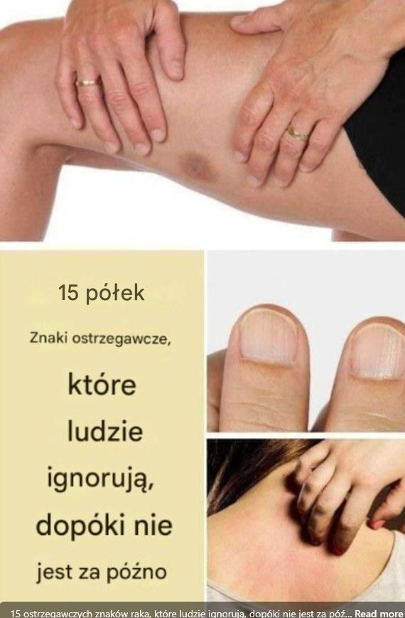 Ciche Sygnały Alarmowe: 15 Objawów, Które Mogą Ostrzegać Przed Rakiem (I Których Nie Wolno Ignorować)”