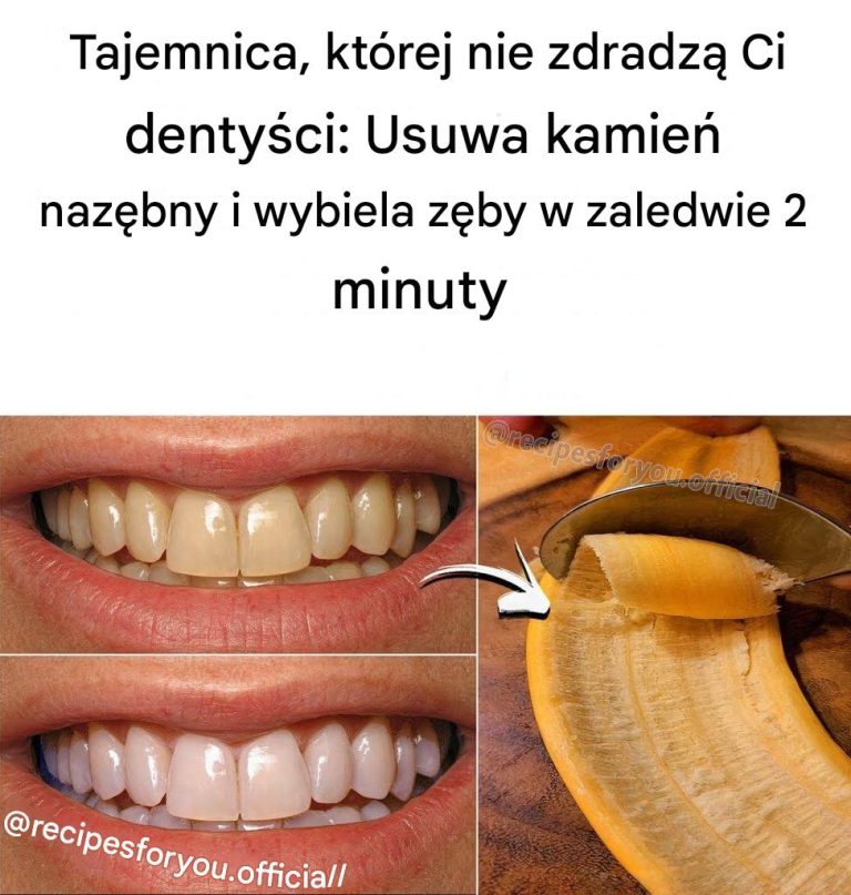 Tajemnica, której nie zdradzą Ci dentyści: Usuwa kamień nazębny i wybiela zęby w zaledwie 2 minuty