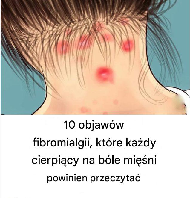 10 cichych sygnałów fibromialgii – nie ignoruj, jeśli doskwiera Ci ból mięśni”