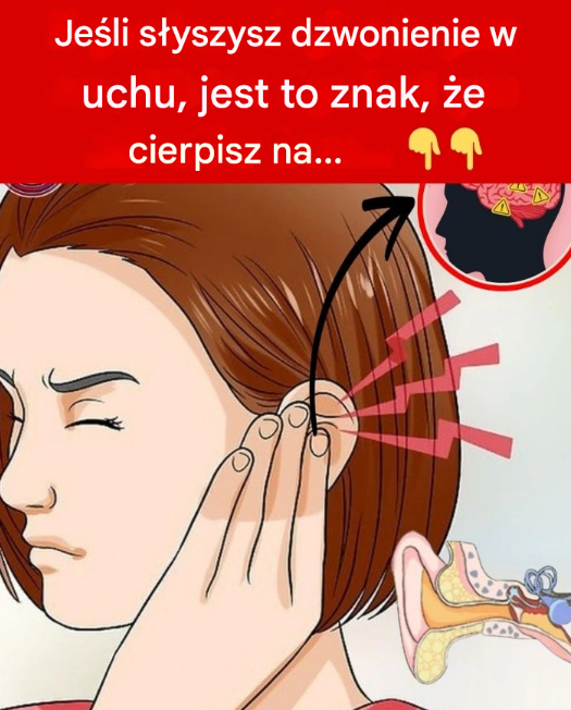Jeśli słyszysz dzwonienie w uchu, może to być znak, że cierpisz na…