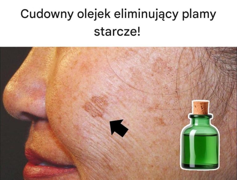 Cudowny olejek eliminujący plamy starcze!