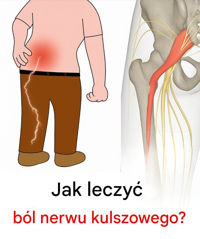 3 ćwiczenia na złagodzenie bólu rwy kulszowej w nodze: praktyczne i skuteczne