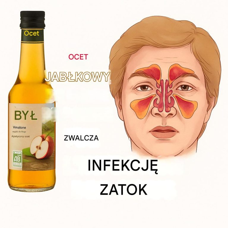 Jak wyleczyć infekcję zatok w kilka minut octem jabłkowym!