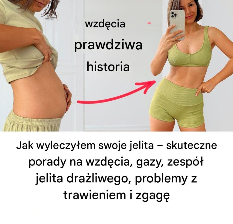 Jak wyleczyłam swoje jelita – skuteczne porady na wzdęcia, gazy, zespół jelita drażliwego, problemy z trawieniem i zgagę