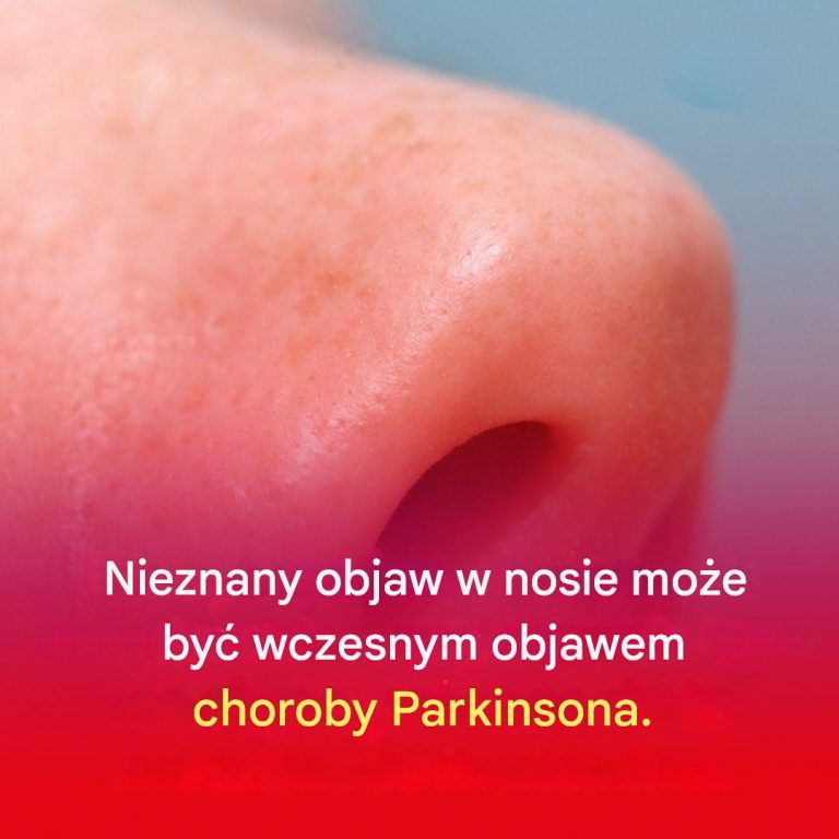 Mało znany objaw w nosie może być wczesnym objawem choroby Parkinsona.