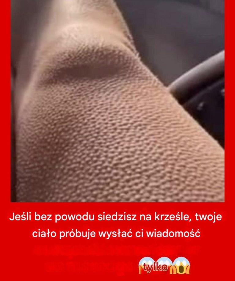 Tajemnicze dreszcze: co ujawniają gęsia skórka?